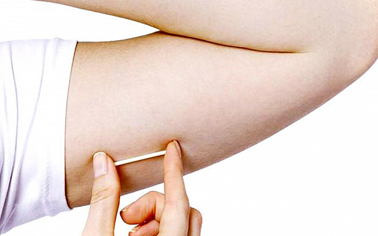 <p>Um exemplo é o chip de gestrinona, amplamente divulgado como tratamento para endometriose, apesar da ausência de pesquisas que confirmem sua eficácia ou segurança.</p>
