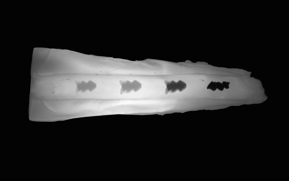 Rob&ocirc;s CARs, moldados em formato de broca dupla h&eacute;lice, fazendo a limpeza no canal de um dente. 