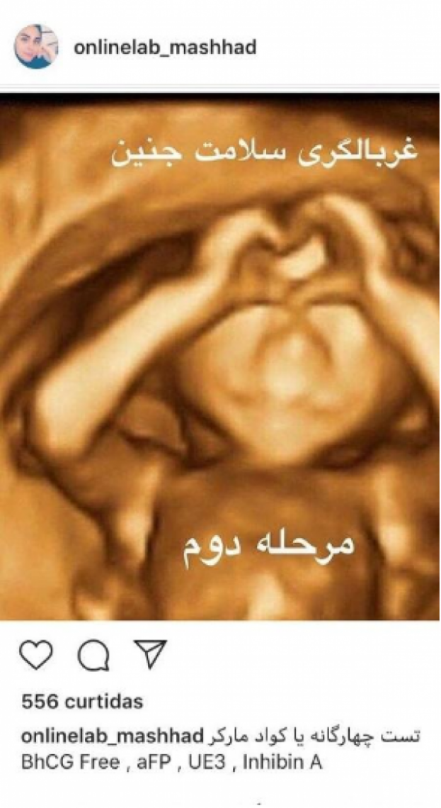 A imagem 'original' rastreada em conta do Instagram no Irã A imagem 'original' rastreada em conta do Instagram no Irã