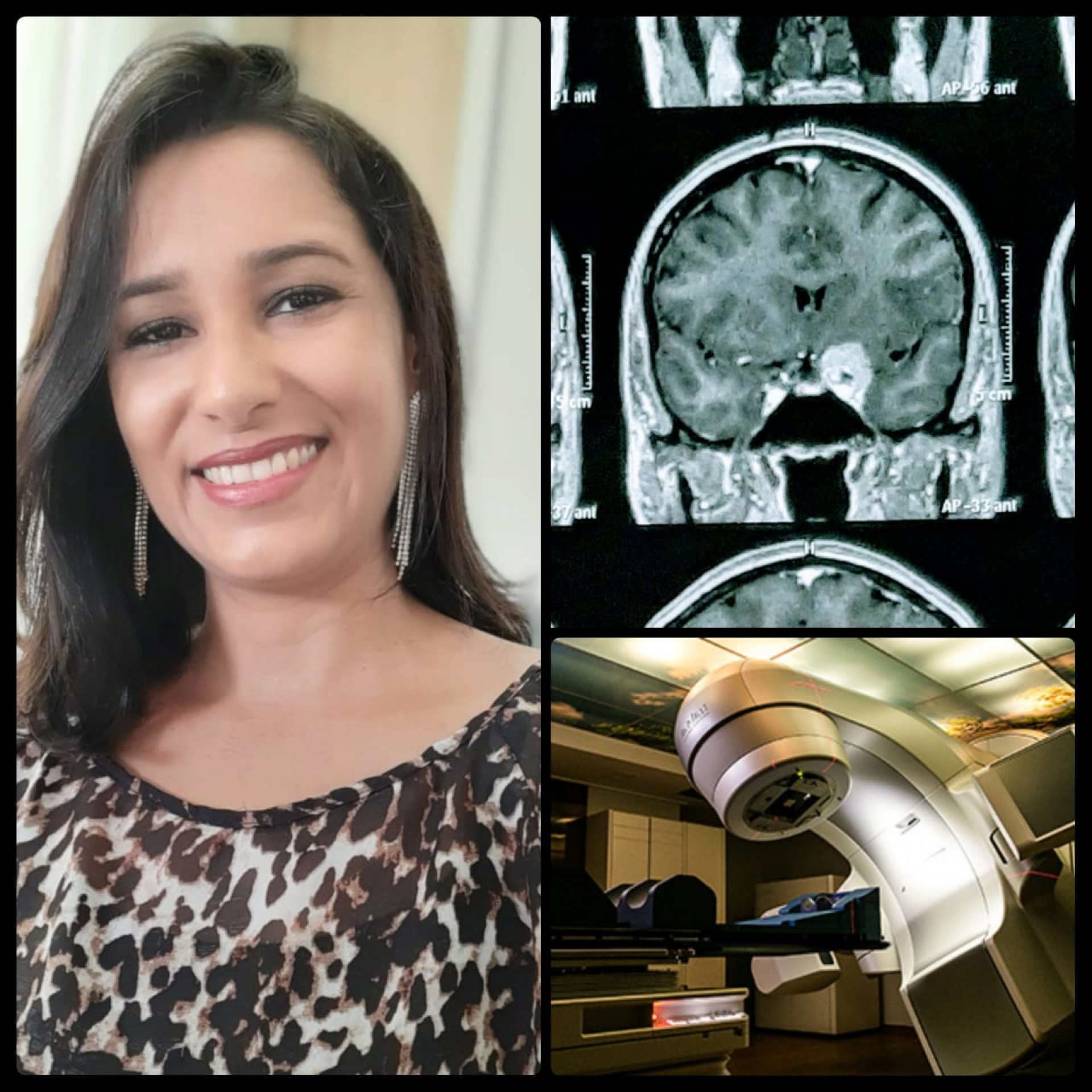 Angélica Tabosa foi diagnosticada com um tumor na cabeça, o qual, para ser retirado, é preciso realizar cirurgia em Recife avaliada em R$ 40 mil
