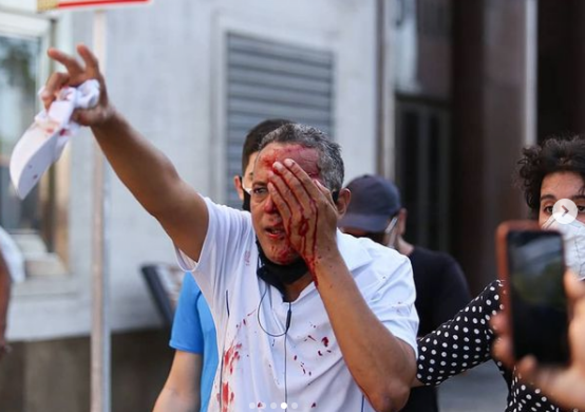 Homem que não participava de protesto foi atingido no olho, em Recife (Foto: Reprodução / Instagram @hugomunizzz)