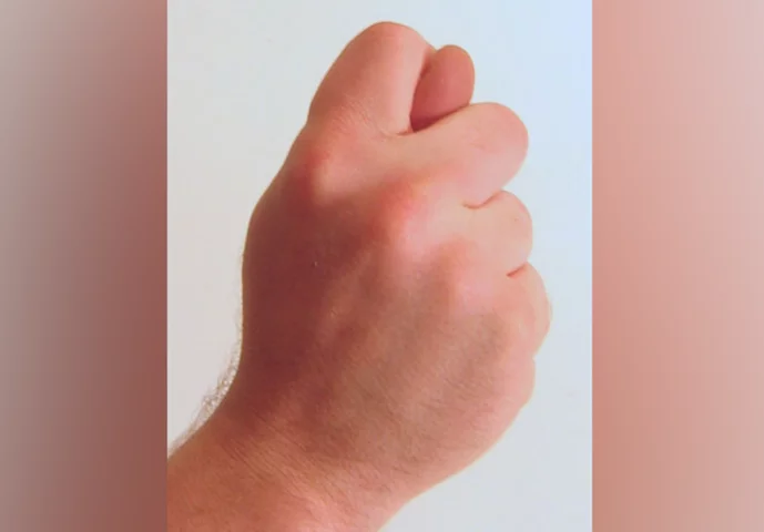 E na Rússia, é um gesto que significa negar algo a alguém ou rir porque a pessoa não conseguiu o que queria. 