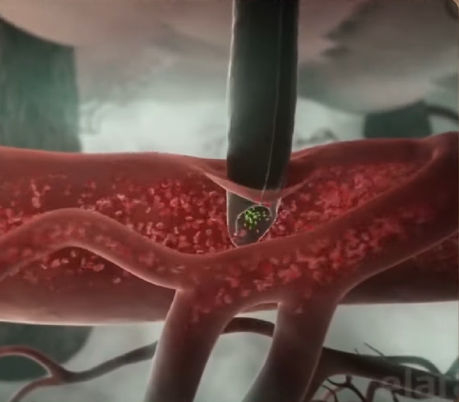 Se a pessoa for alérgica, o veneno pode levar ao desenvolvimento de pancreatite e edema pulmonar.