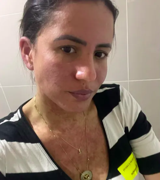 Eu achei que eu ia morrer. Fiz até vídeo me despedindo, juro que achei que ia morrer. E Deus me deu mais uma oportunidade, continuou Caroline.