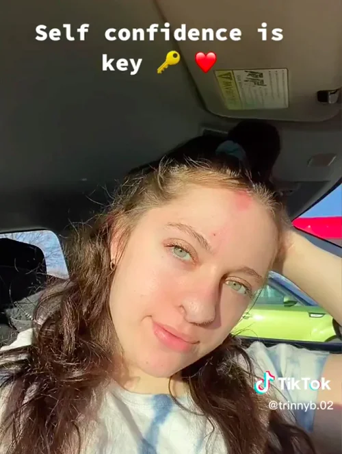 A enfermeira contou que vem sofrendo críticas nas redes sociais por conta da sua aparência. Mas que, apesar da experiência ter sido terrível, ela se sente feliz de estar viva no momento.