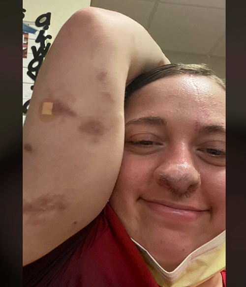 O ataque deixou Rowles com ferimentos na orelha, braço, mão e nariz.