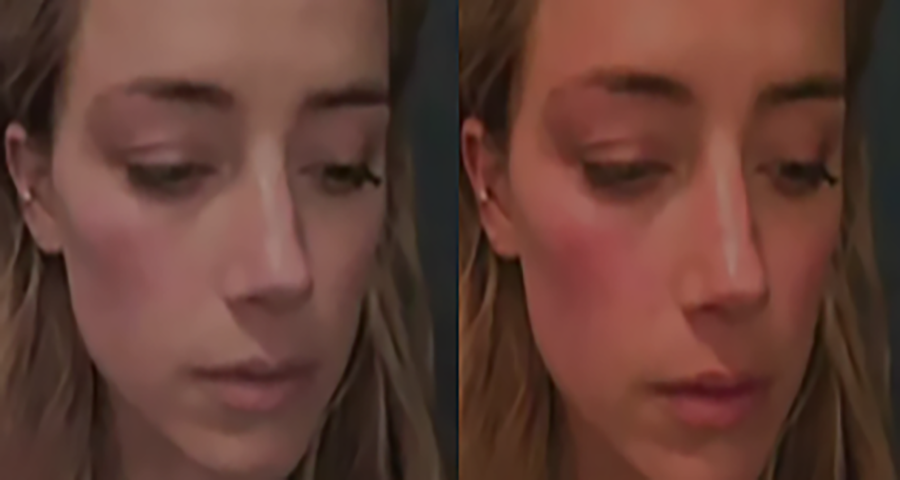 Amber apresentou uma foto com rosto vermelho após suposta agressão do marido. Mas a defesa de Depp comparou com outra fotografia da mesma ocasião, em que o rosto estava mais claro. E um especialista testemunhou dizendo que a atriz teria editado a foto. 