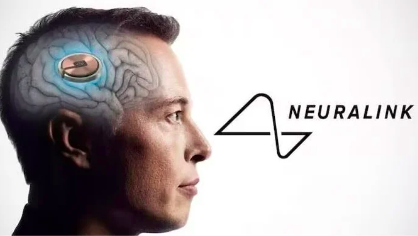 A Neuralink, empresa do bilionário Elon Musk, realizou com sucesso no começo de 2024 o primeiro implante de um chip cerebral em um ser humano. O FLIPAR mostrou e relembra um