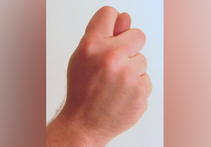 E na Rússia, é um gesto que significa negar algo a alguém ou rir porque a pessoa não conseguiu o que queria. 