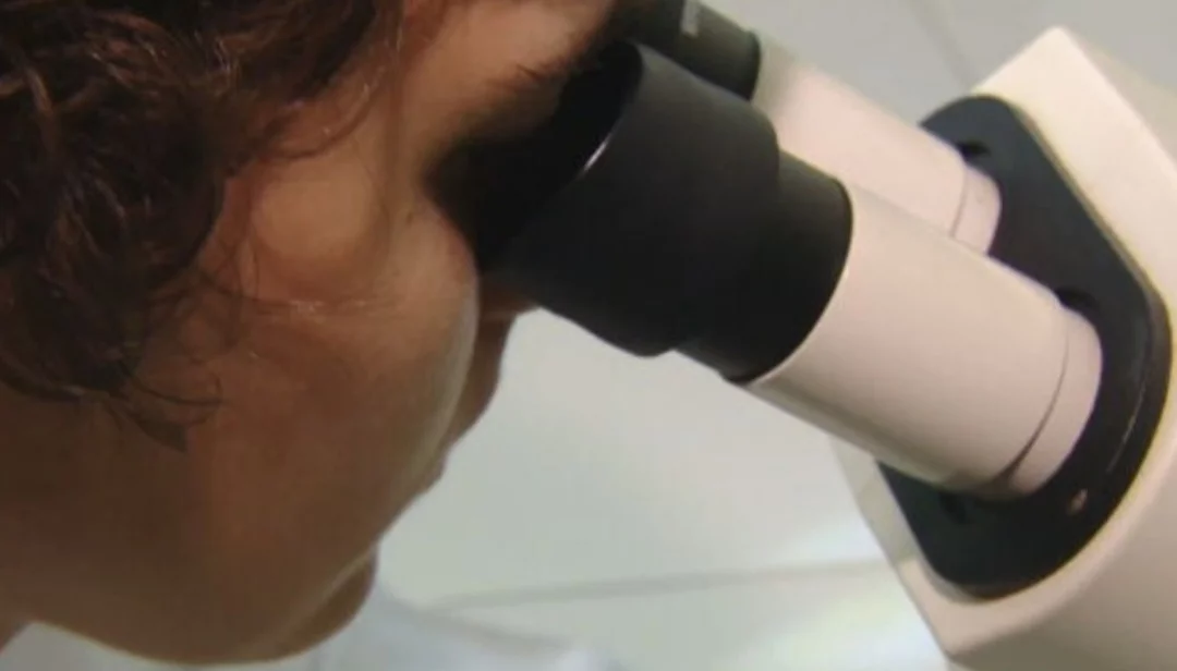 Mesmo com tratamento, o linfoma pode recorrer ou ser refratário, exigindo outras abordagens terapêuticas. A pesquisa clínica continua avançando, com novos medicamentos e técnicas de terapia celular em estudo.