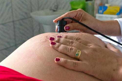 Consultas de pré-natal foram prejudicadas pela pandemia (Foto: O POVO)
